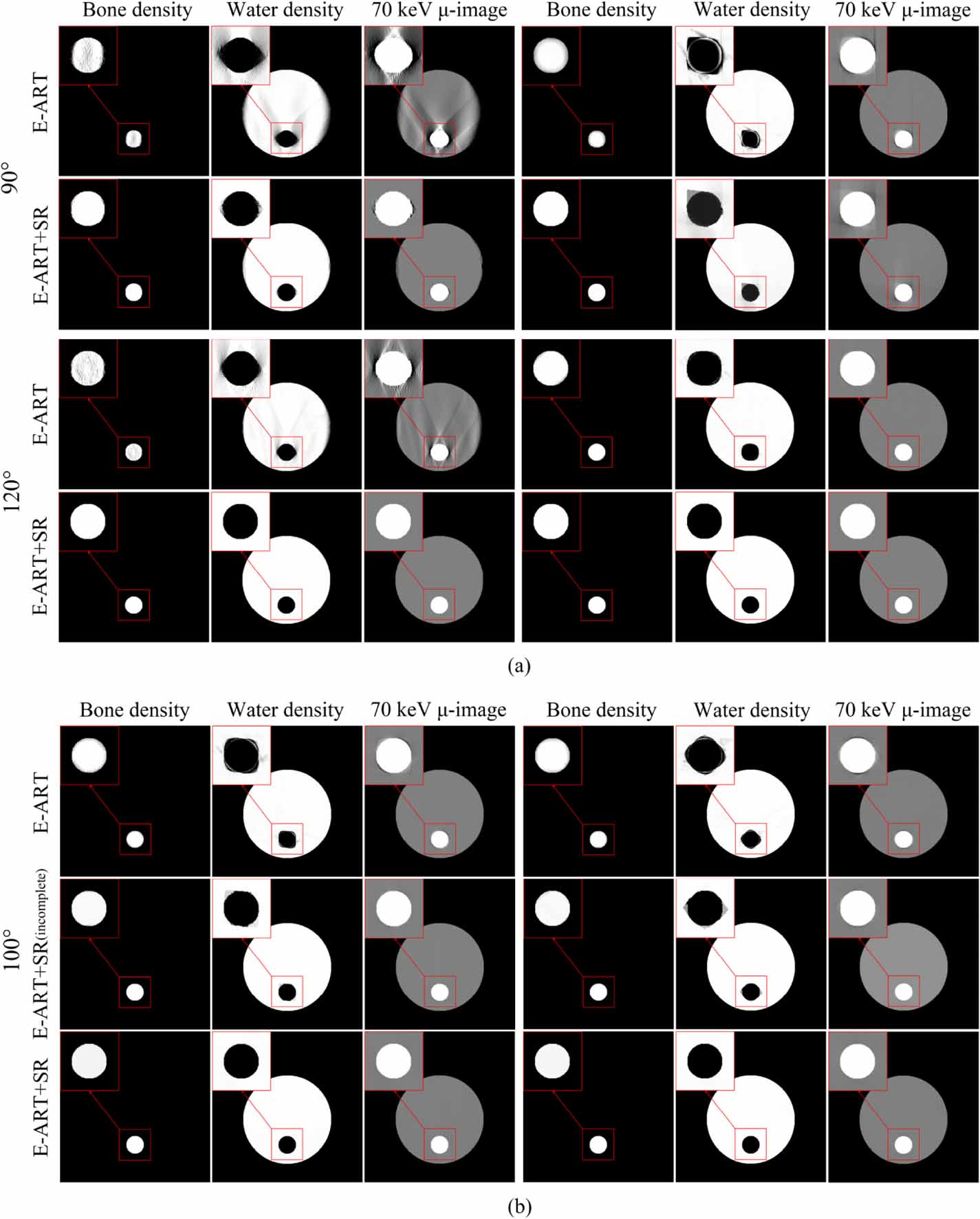 A sequential regularization based image reconstruction method for ...