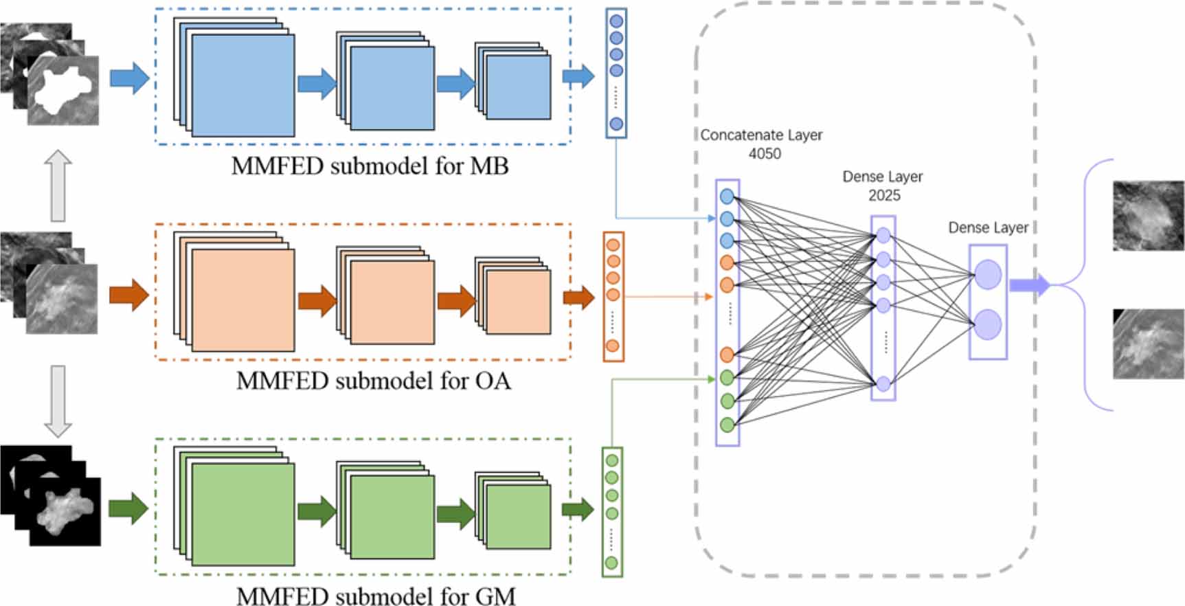 Multi-path synergic fusion deep neural network framework for breast ...