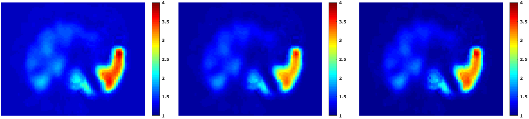 A deep learning approach to radiation dose estimation - IOPscience