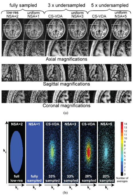 Compressed sensing MRI with variable density averaging (CS-VDA ...