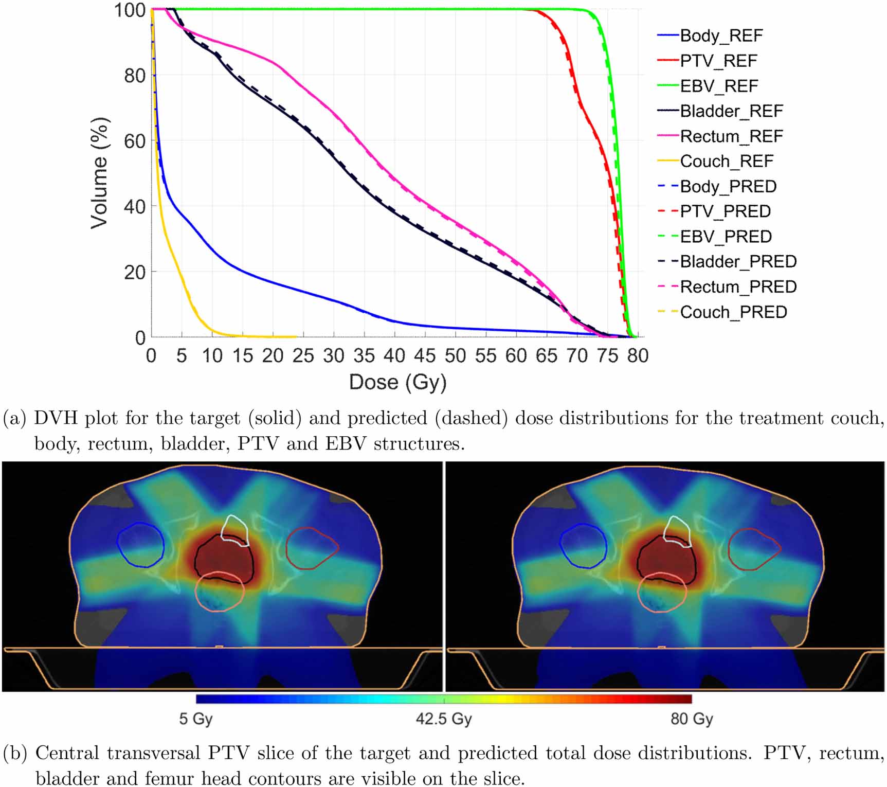 DeepDose: Towards a fast dose calculation engine for radiation therapy ...
