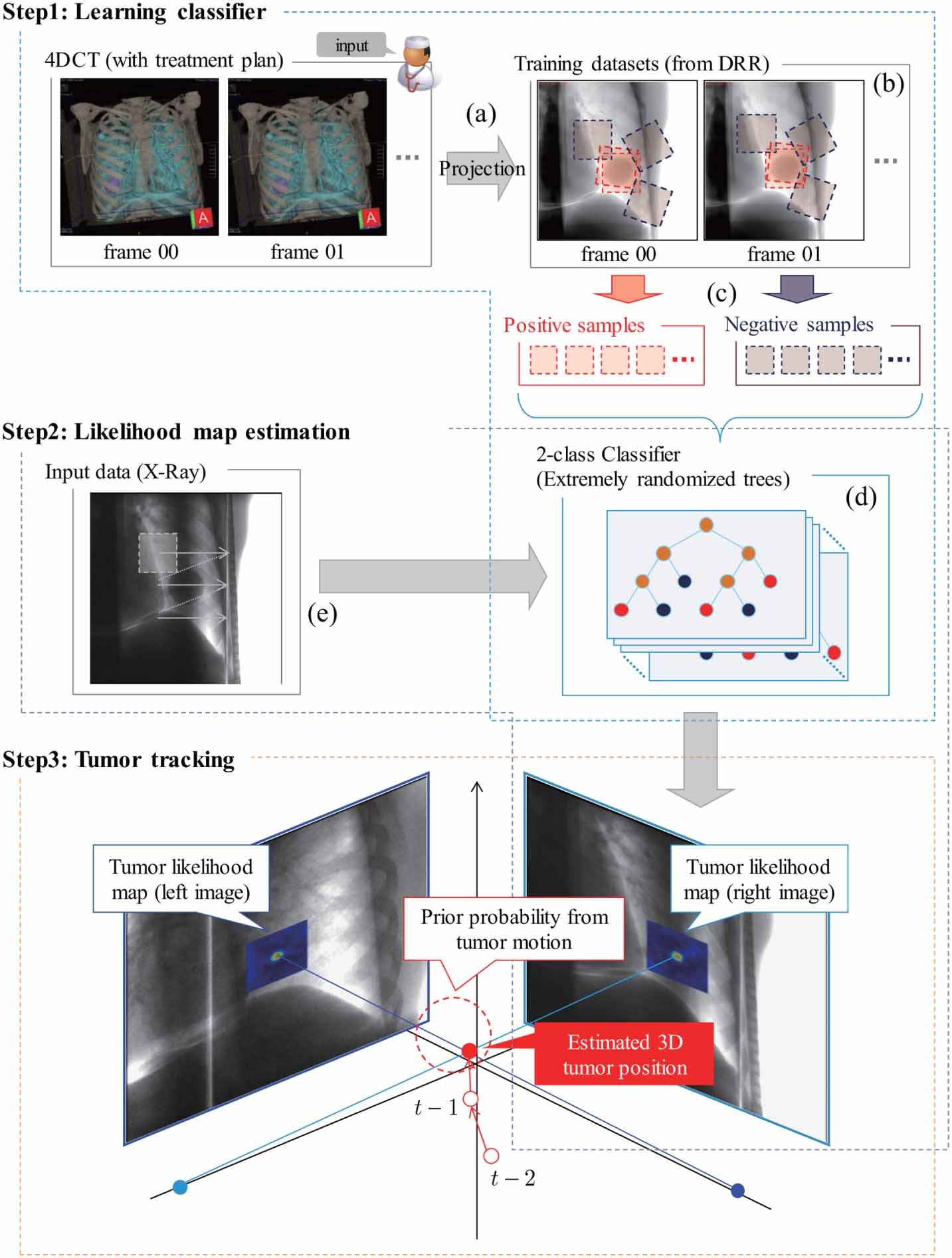 A machine learning-based real-time tumor tracking system for ...