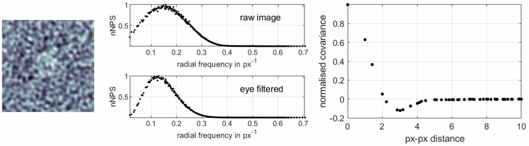 Scan Rdi Results RDI a regression detectability index for quality assurance in: x-ray ...