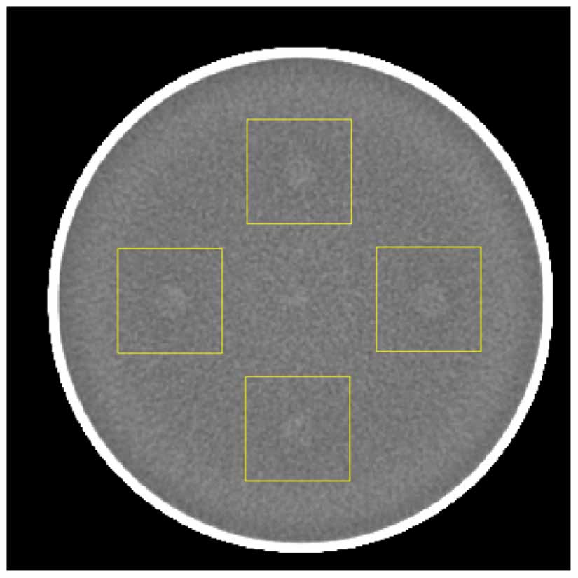 Fifu Scan Rdi RDI a regression detectability index for quality assurance in: x-ray ...