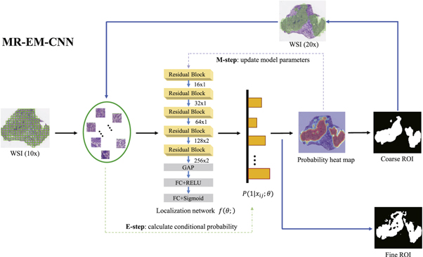 Lung cancer subtype classification using histopathological images based ...