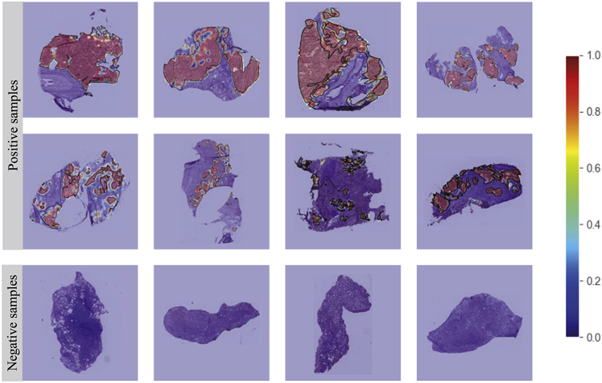 Lung cancer subtype classification using histopathological images based ...