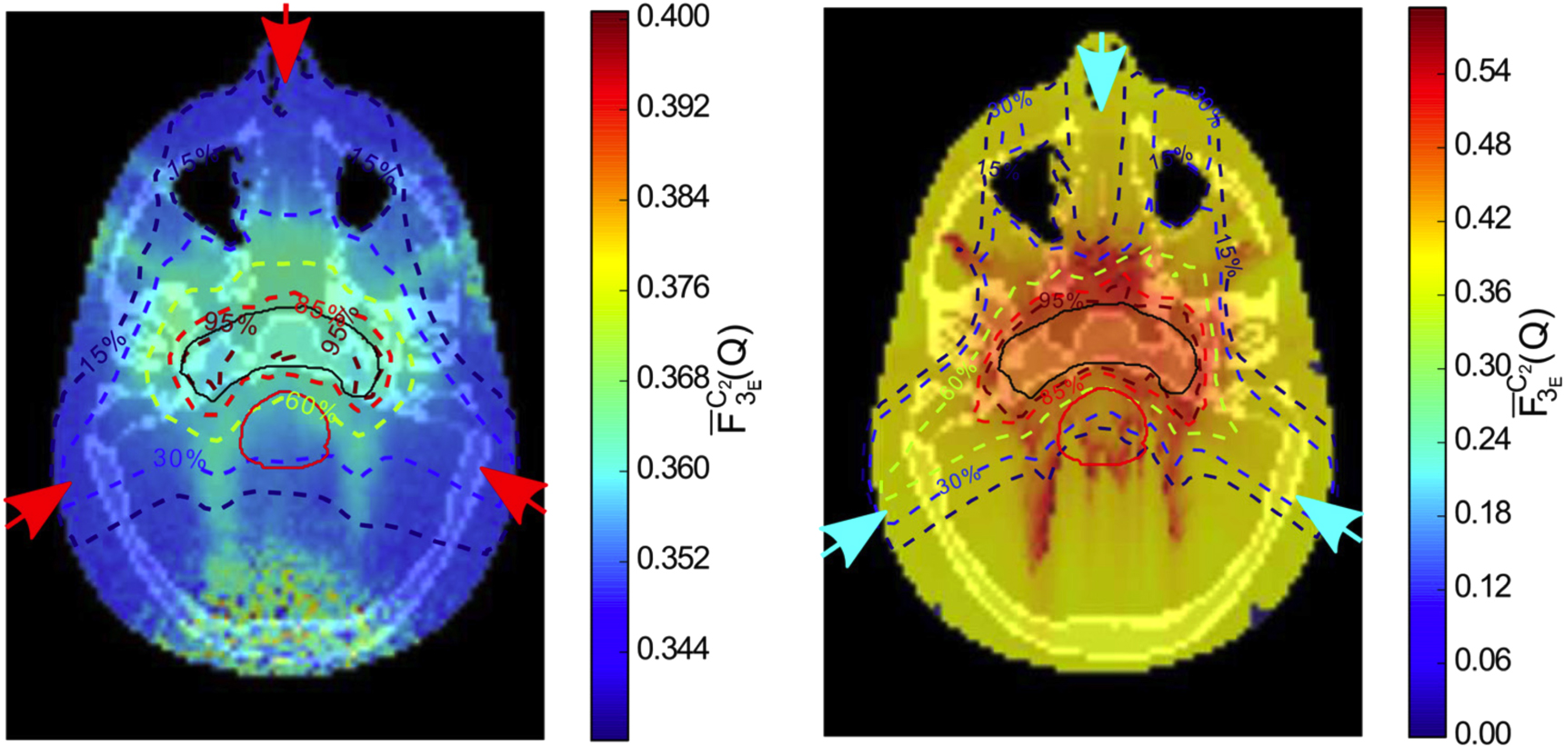 20点 Applications of nanodosimetry in particle therapy planning