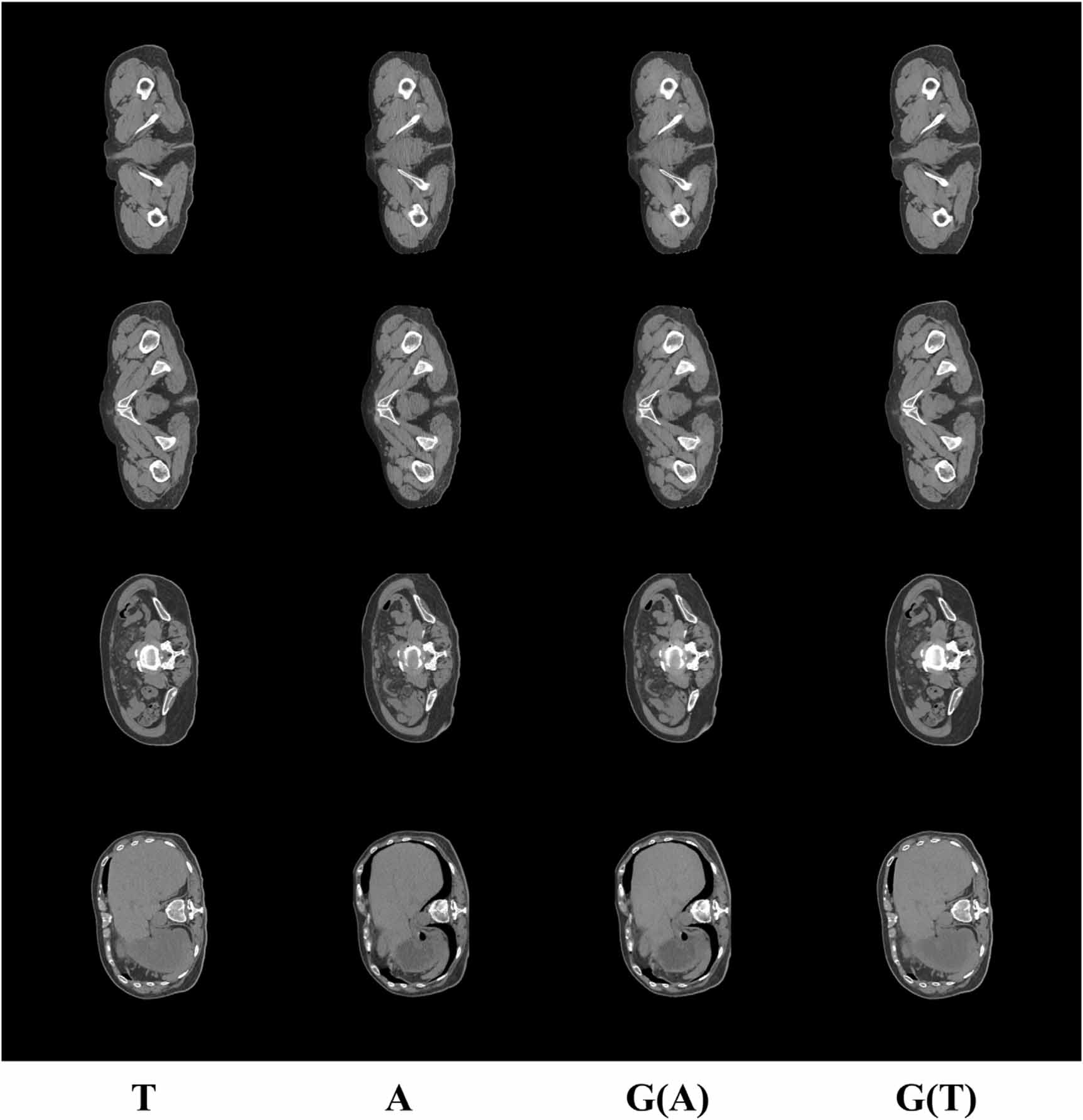 Normalization of multicenter CT radiomics by a generative adversarial ...
