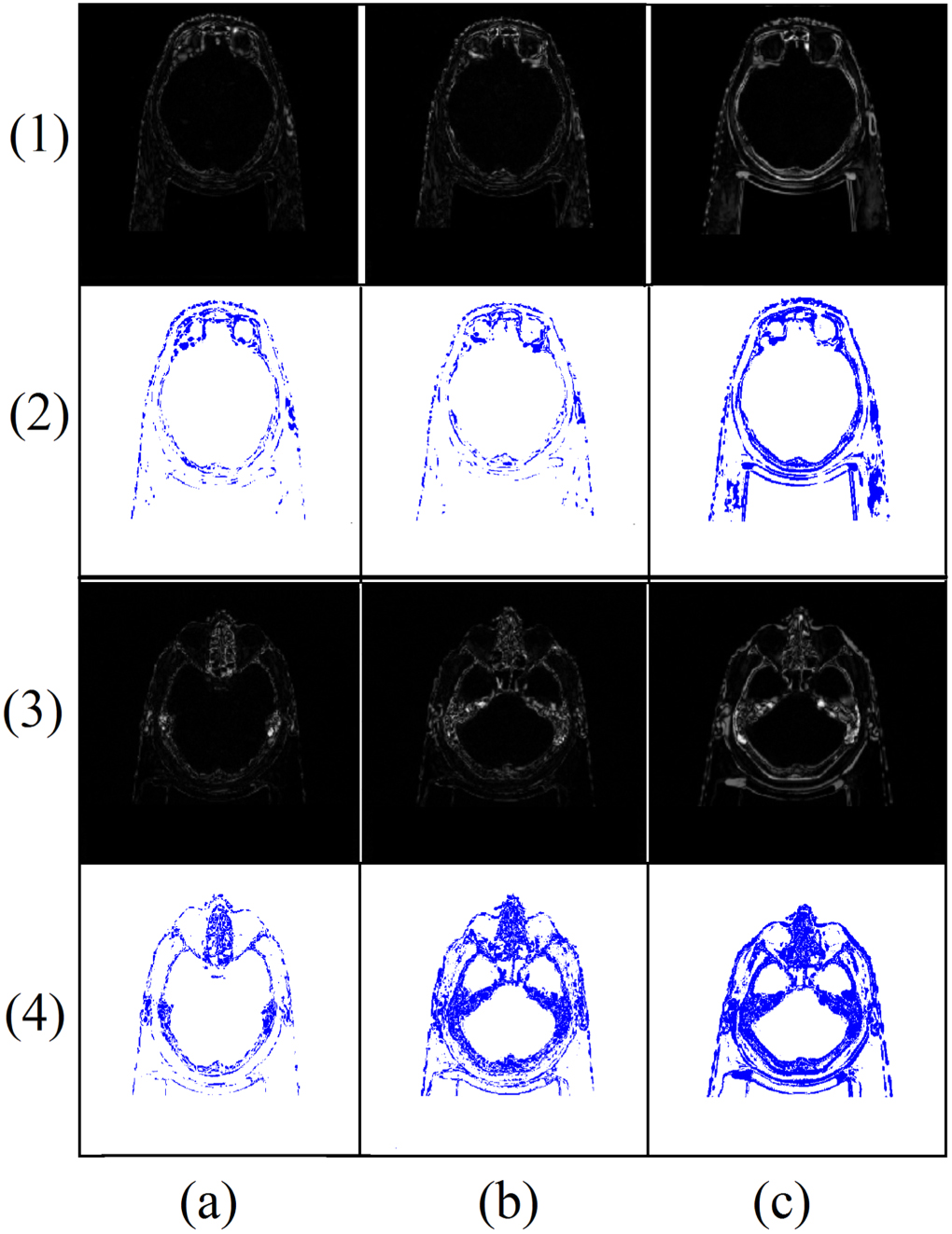 A feature invariant generative adversarial network for head and neck ...