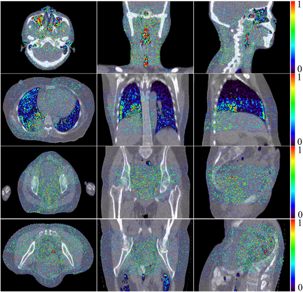 Development of a GPU-superposition Monte Carlo code for fast dose ...