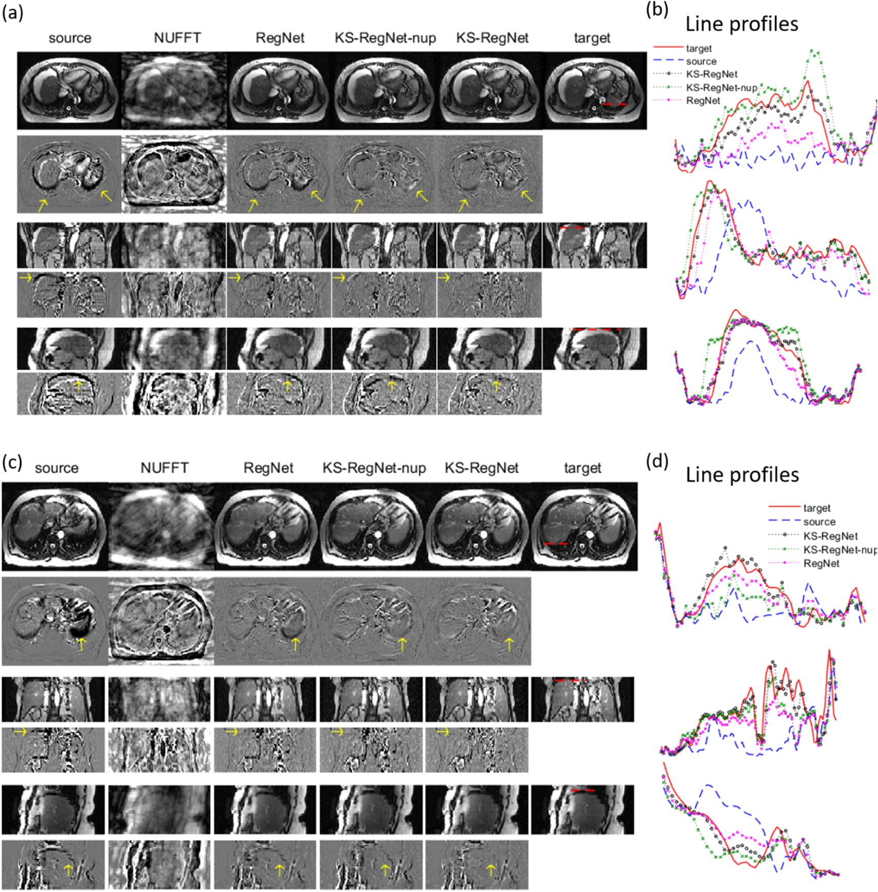 Real-time MRI motion estimation through an unsupervised k-space