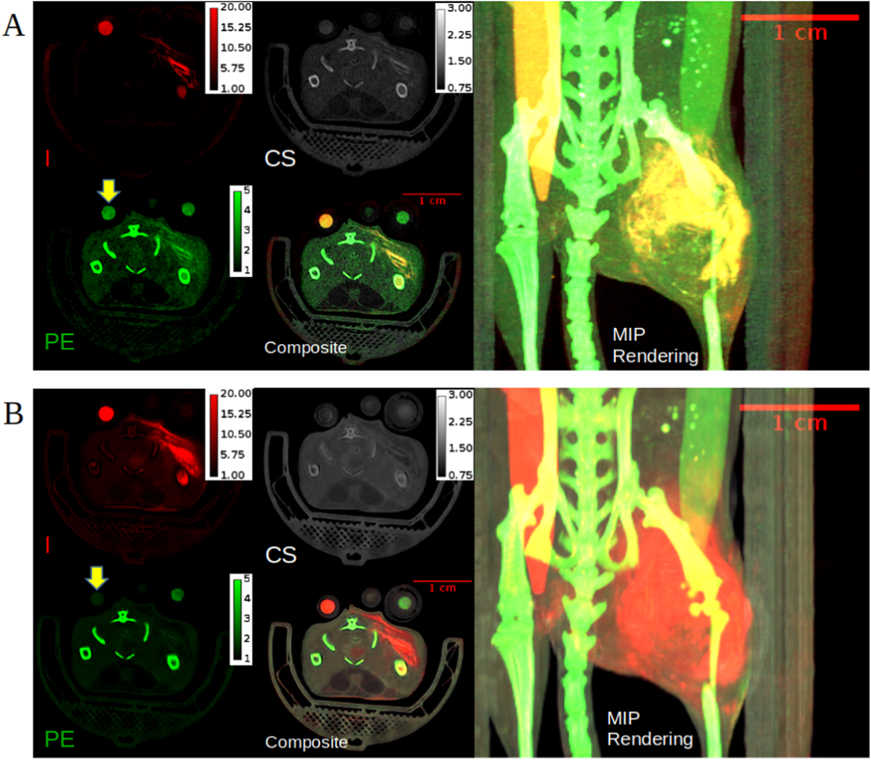 Material decomposition from photon-counting CT using a convolutional ...