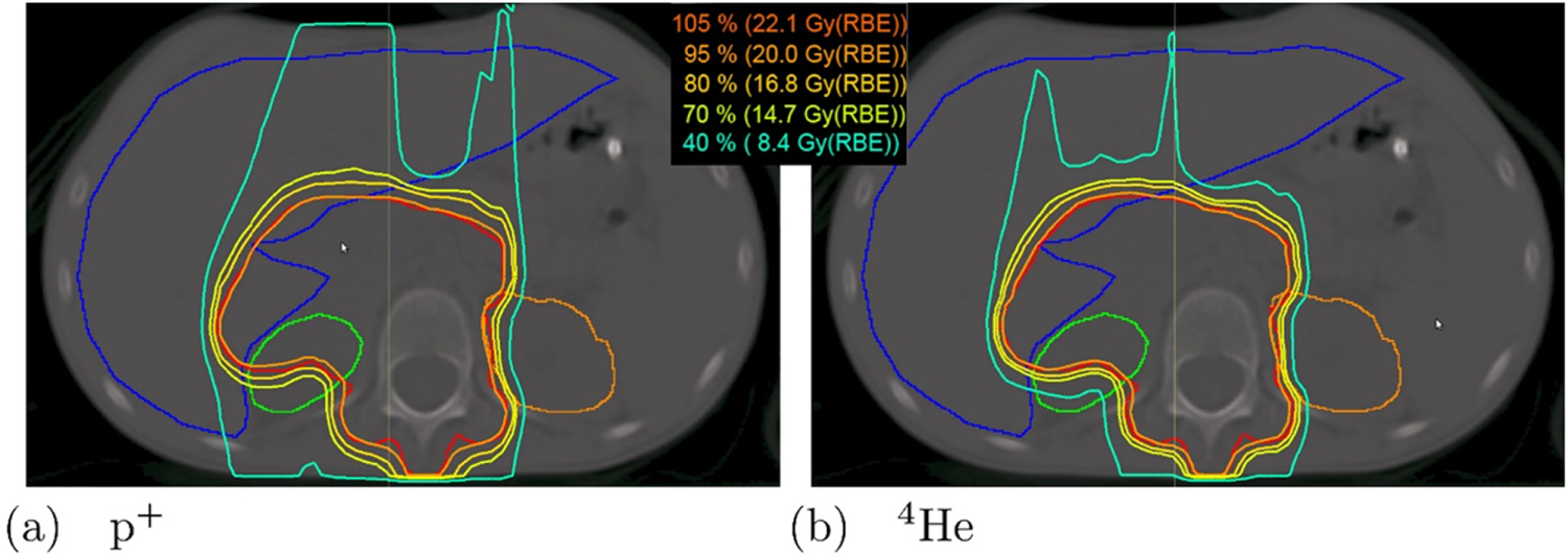 Roadmap: helium ion therapy - IOPscience