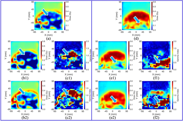 Validation of a deep learning-based material estimation model for Monte ...