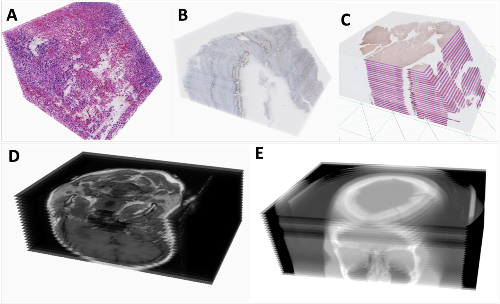 Pathology Image Complex An integrative web-based software tool for multi-dimensional pathology ...
