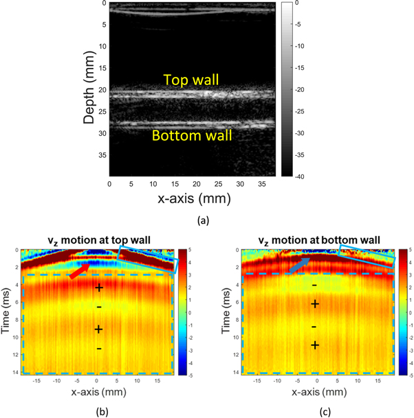 Using Field Ii Measurement of wave propagation through a tube using dual transducers ...