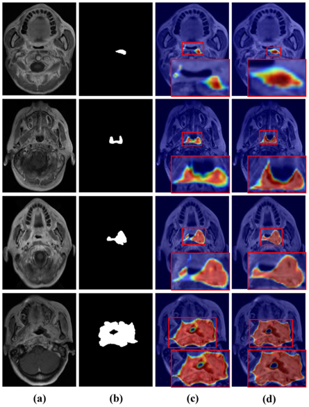 Multi-scale contextual semantic enhancement network for 3D medical ...