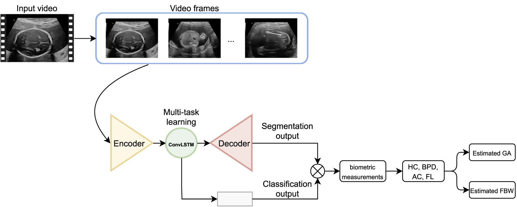 Deep learning fetal ultrasound video model match human observers in ...