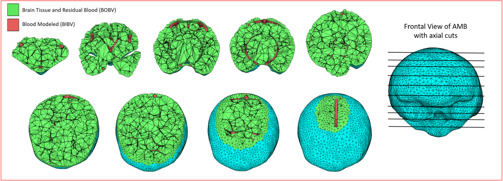 Intra-brain vascular models within the ICRP mesh-type adult reference ...