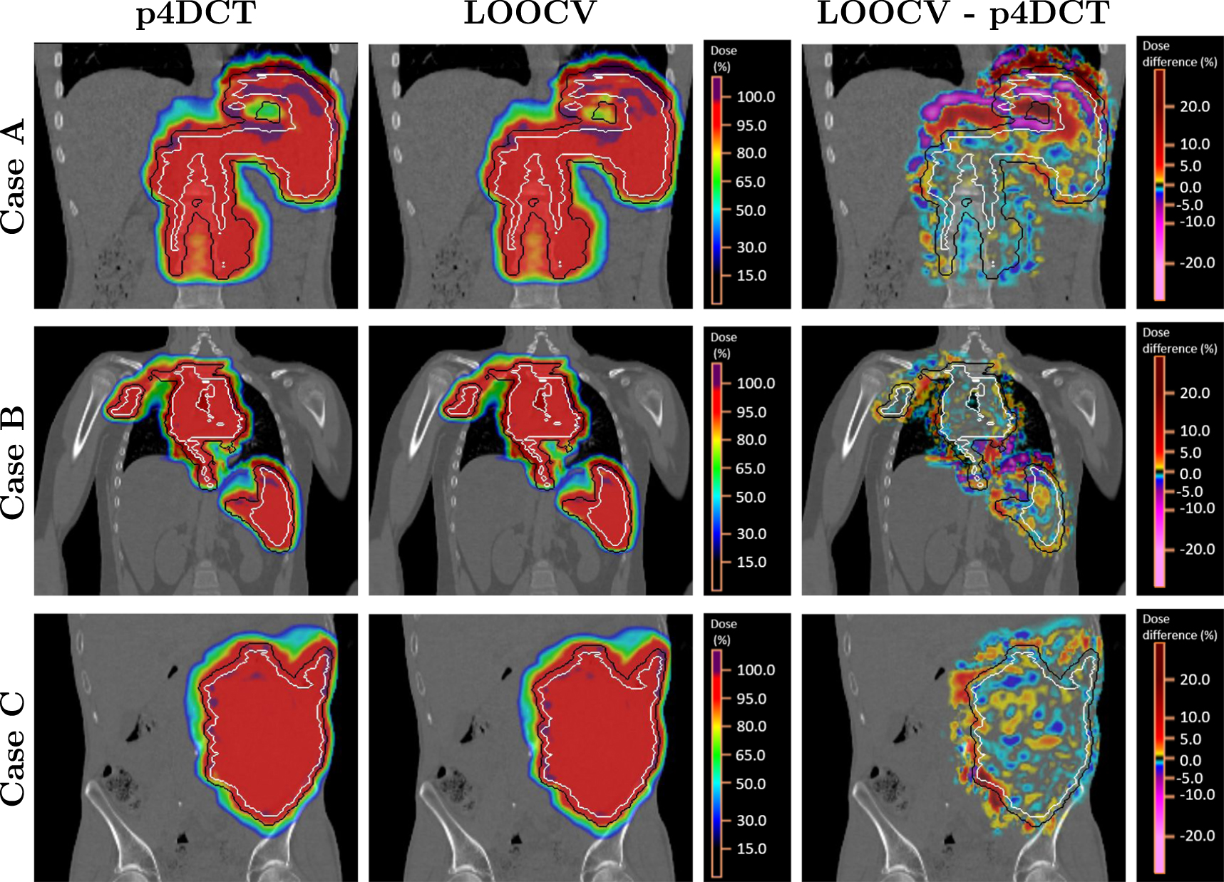 A motion model-guided 4D dose reconstruction for pencil beam scanned ...