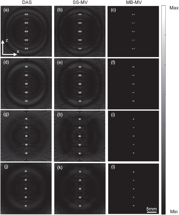 Multibeam minimum variance beamforming for ring array ultrasound ...