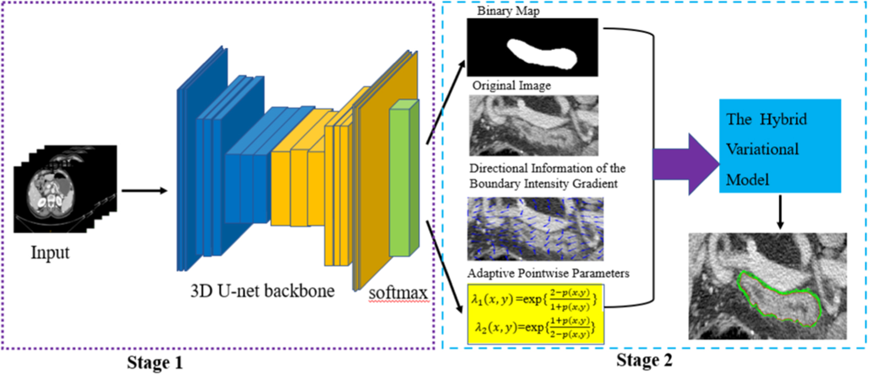 A two-stage data-model driven pancreas segmentation strategy embedding ...