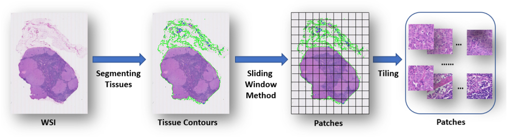 Iterative multiple instance learning for weakly annotated whole slide ...
