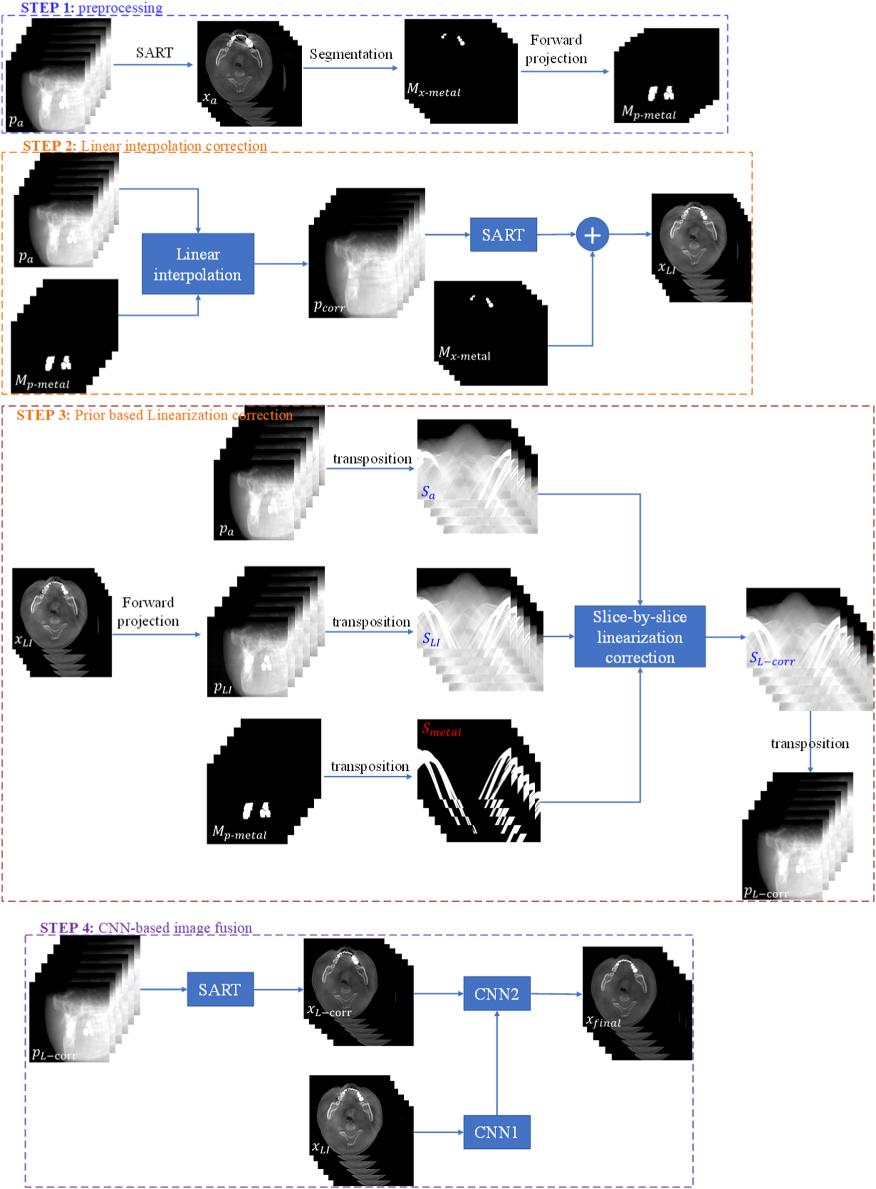 A new dental CBCT metal artifact reduction method based on a dual ...