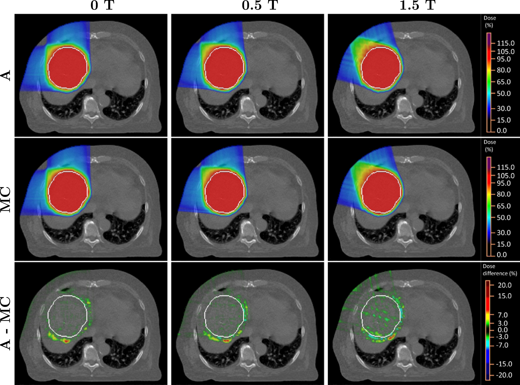 A fast analytical dose calculation approach for MRI-guided proton ...