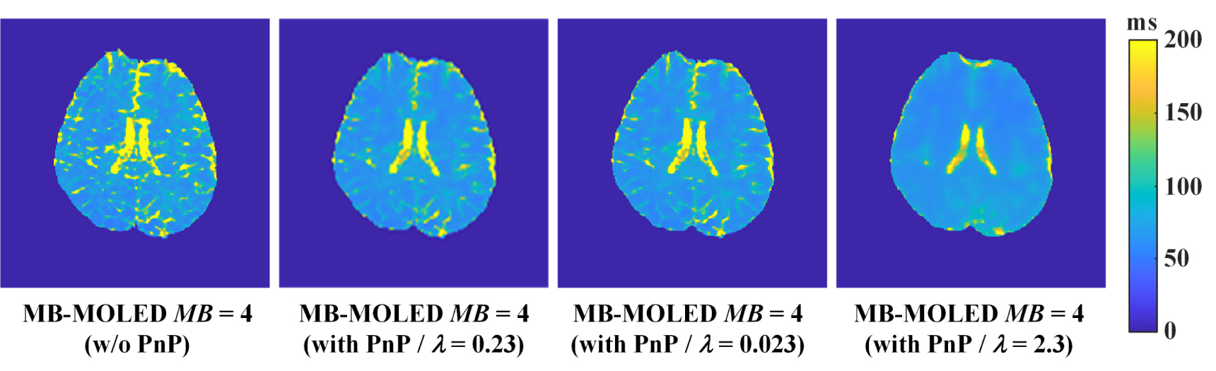 Sub-second whole brain T2 mapping via multiband SENSE