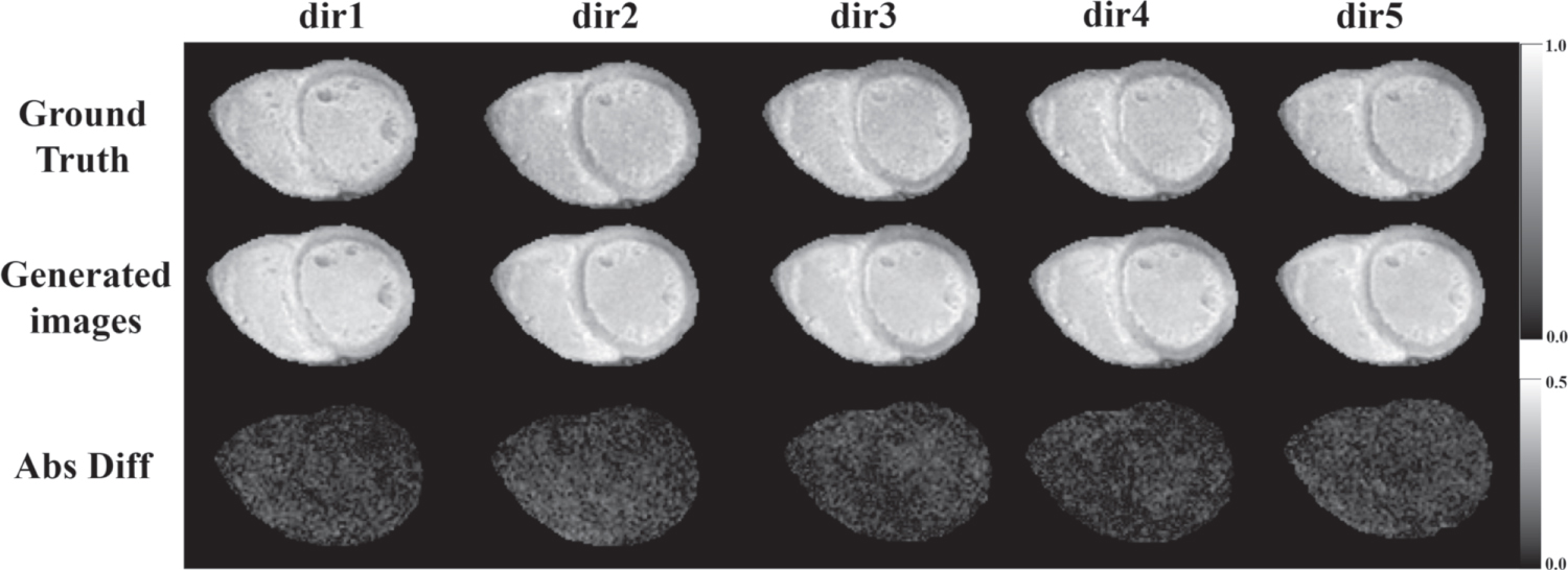 Accelerated cardiac diffusion tensor imaging using deep neural network ...