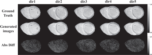Accelerated cardiac diffusion tensor imaging using deep neural network ...