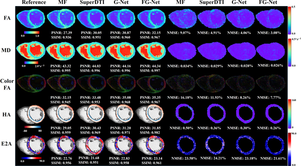 Accelerated cardiac diffusion tensor imaging using deep neural network ...
