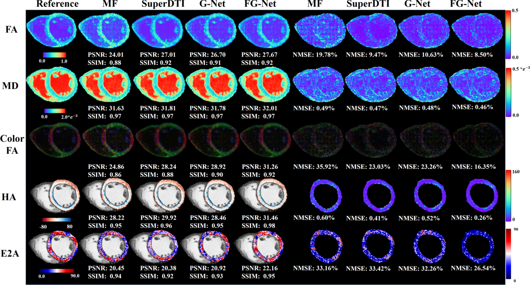 Accelerated cardiac diffusion tensor imaging using deep neural network ...