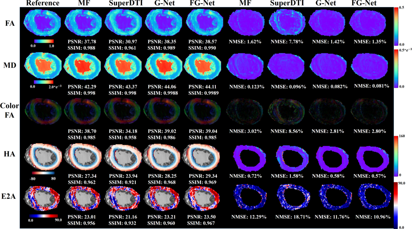 Accelerated cardiac diffusion tensor imaging using deep neural network ...