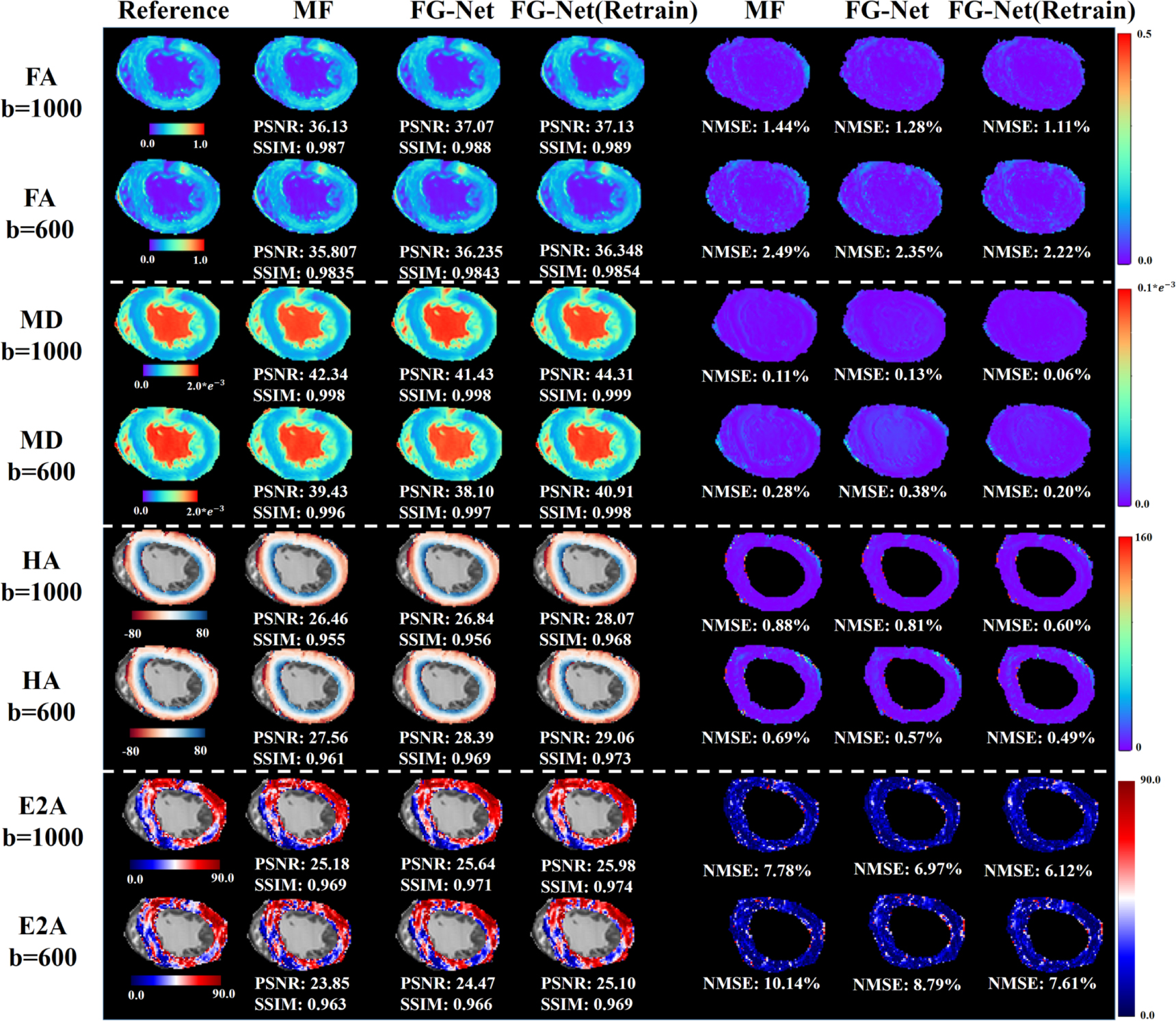 Accelerated cardiac diffusion tensor imaging using deep neural network ...