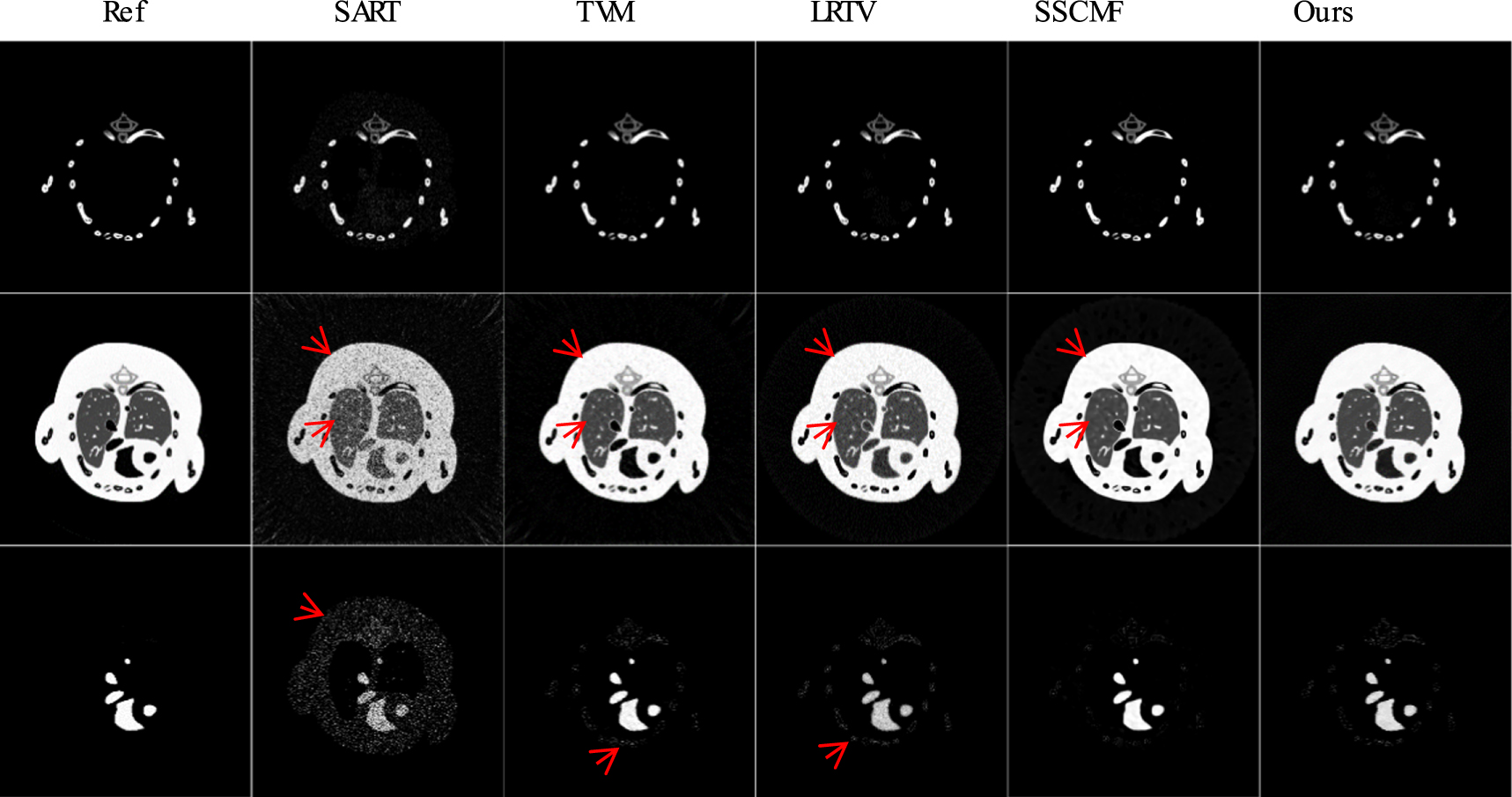 Spectral CT reconstruction via low-rank representation and structure ...