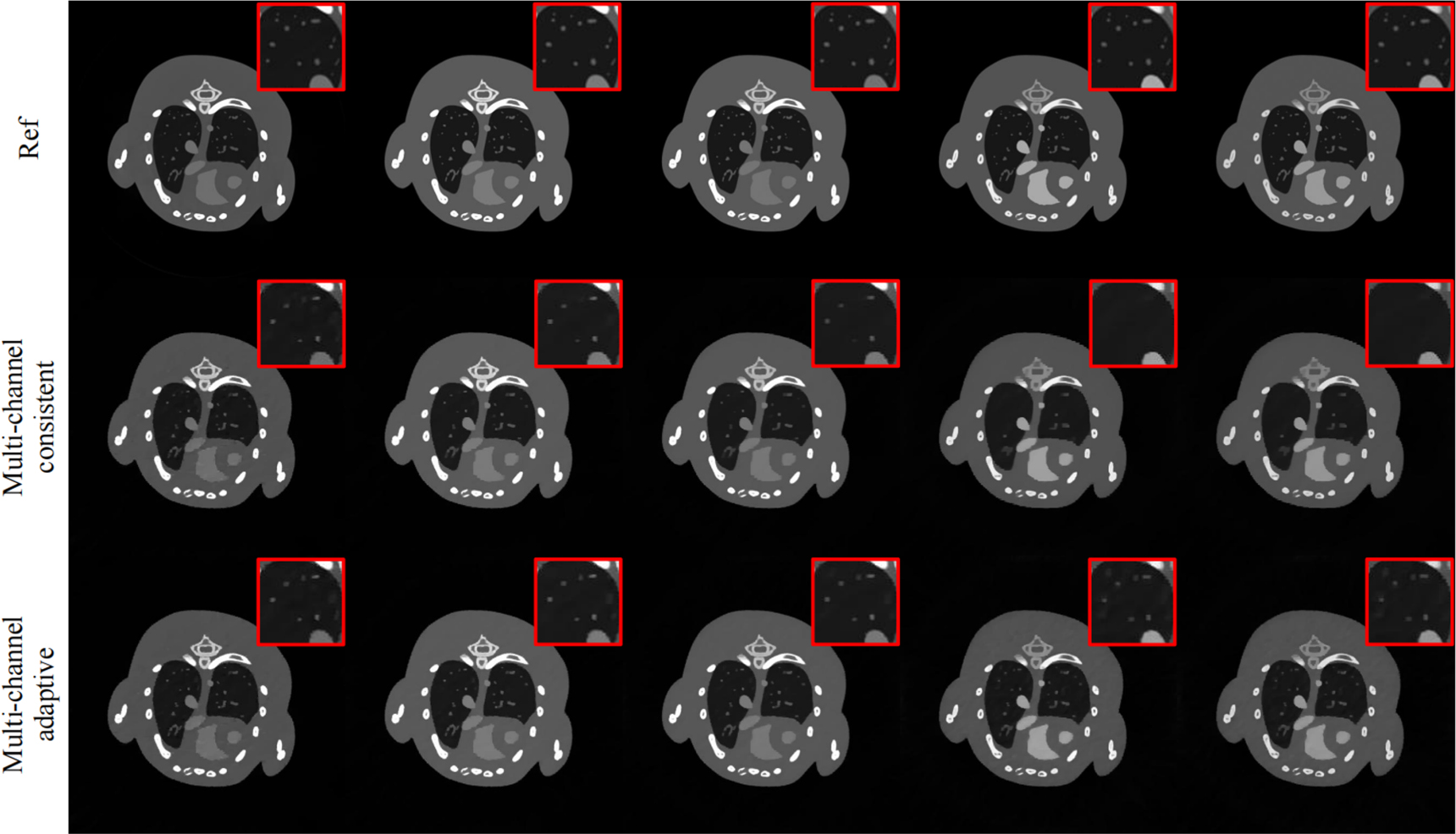 Ct Image Complex Example Spectral CT reconstruction via low-rank representation and structure ...