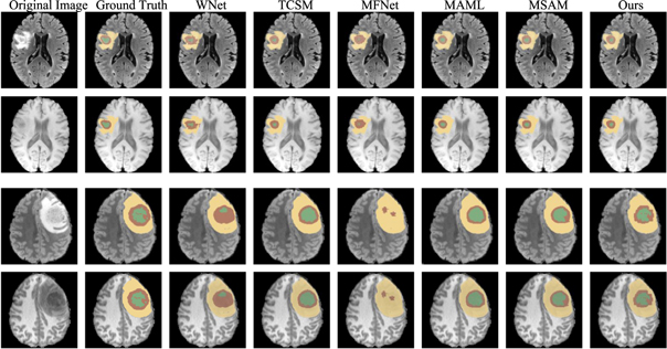 Automated multi-modal Transformer network (AMTNet) for 3D medical ...