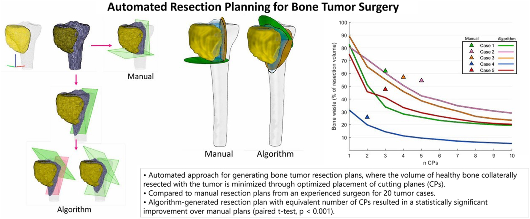 A review of advances in image-guided orthopedic surgery - IOPscience