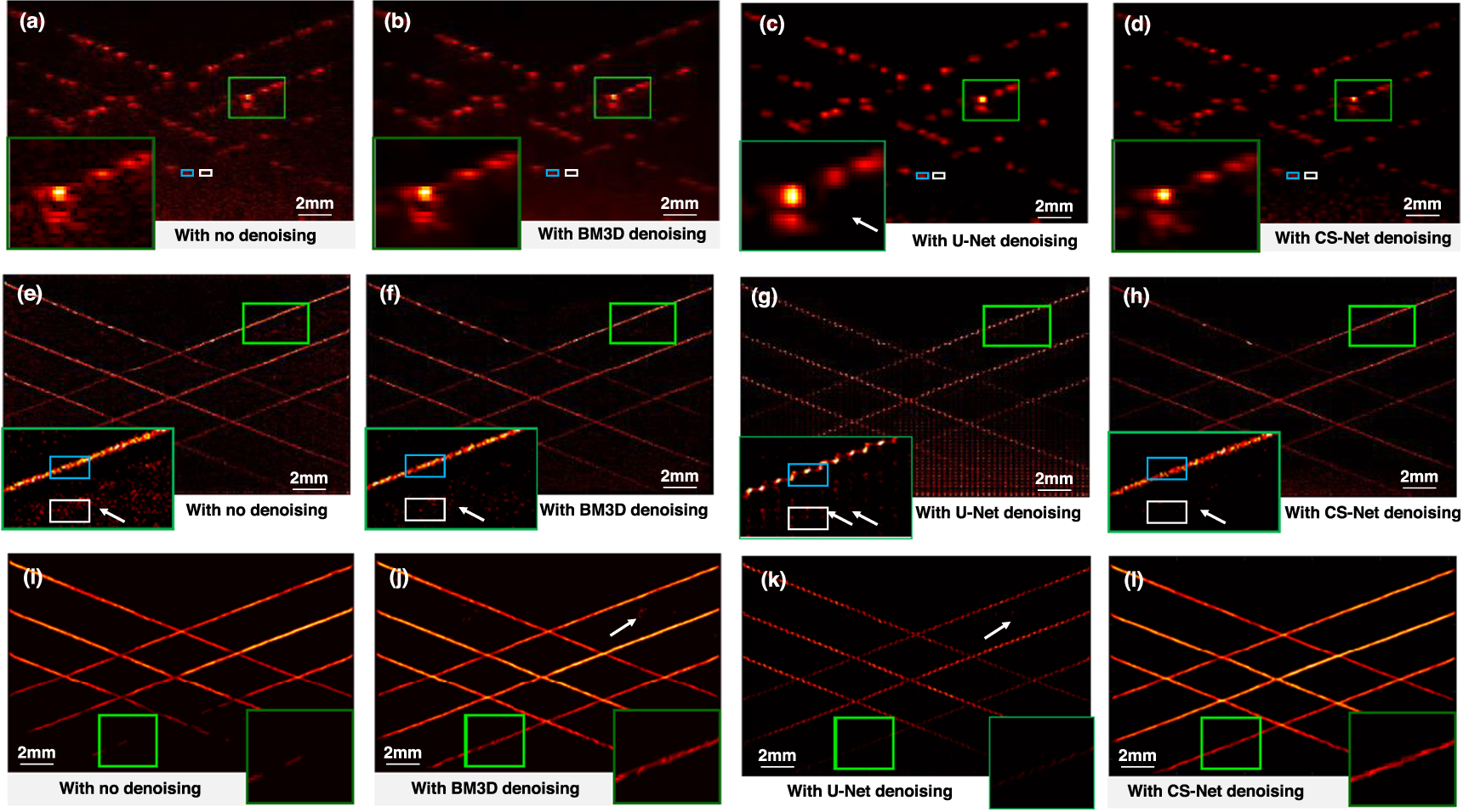 Deep learning for fast denoising filtering in ultrasound localization ...