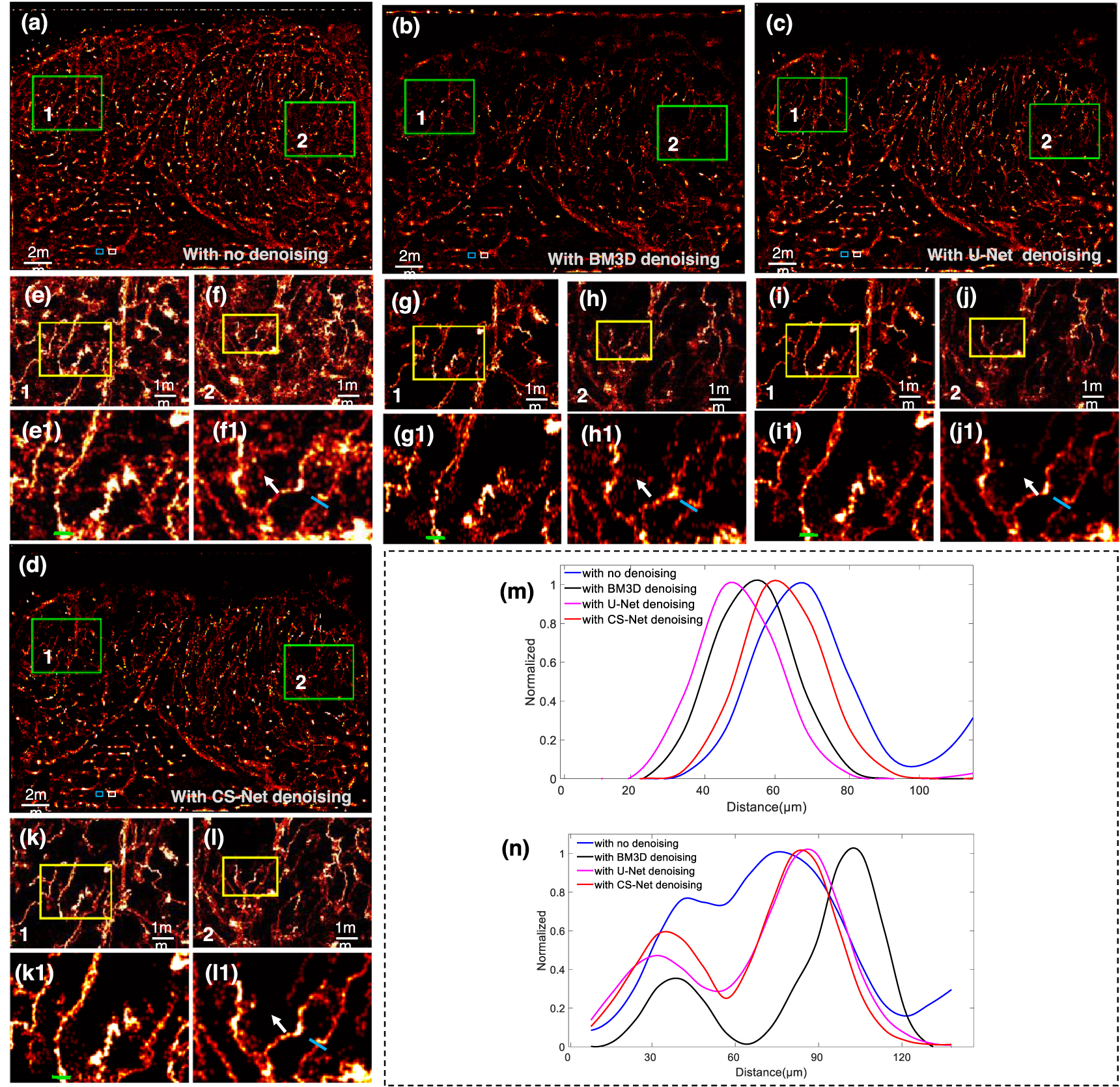 Deep learning for fast denoising filtering in ultrasound localization ...