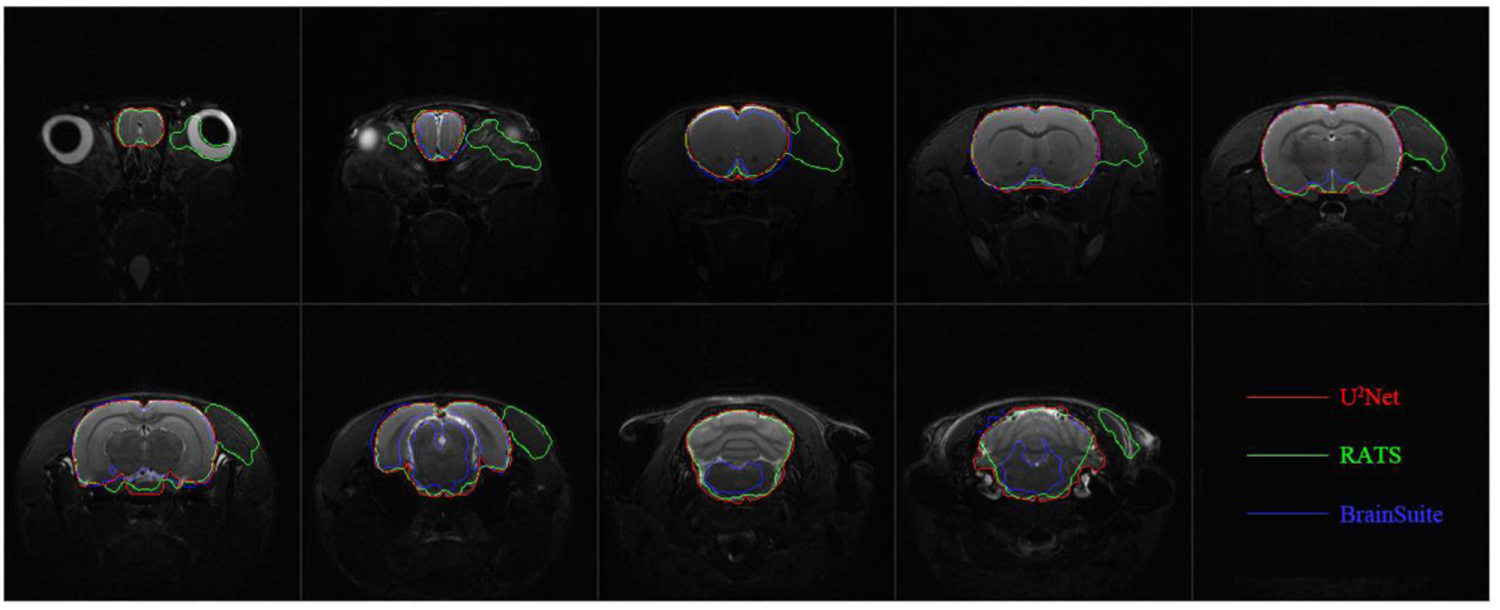 Automatic brain extraction for rat magnetic resonance imaging data ...