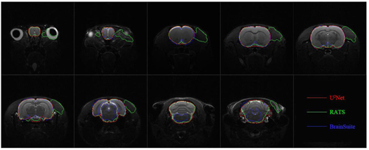 Automatic brain extraction for rat magnetic resonance imaging data ...