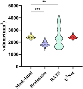 Automatic brain extraction for rat magnetic resonance imaging data ...