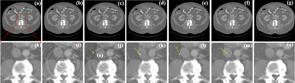 Ring artifacts correction for computed tomography image using ...