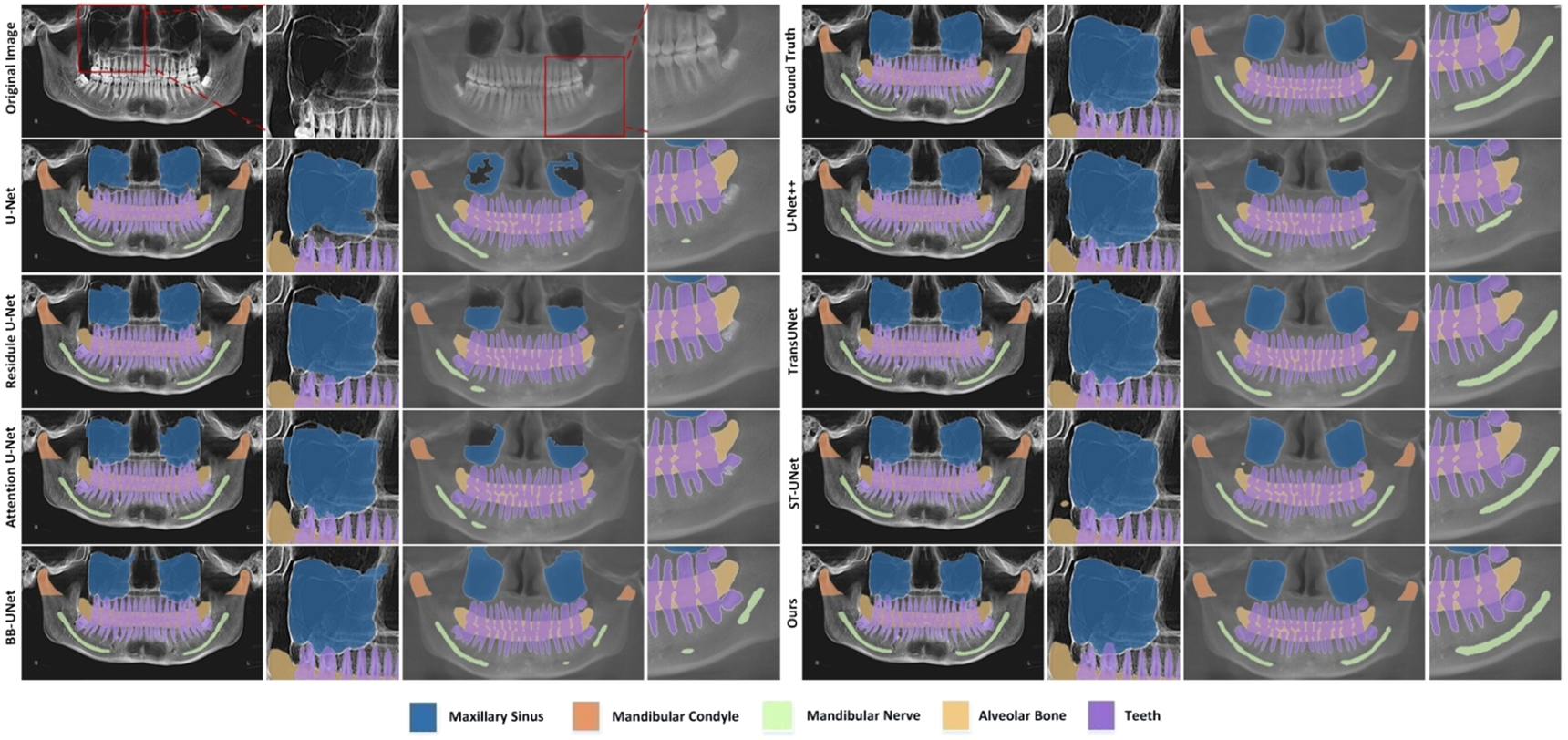 Coarse-to-fine prior-guided attention network for multi-structure ...