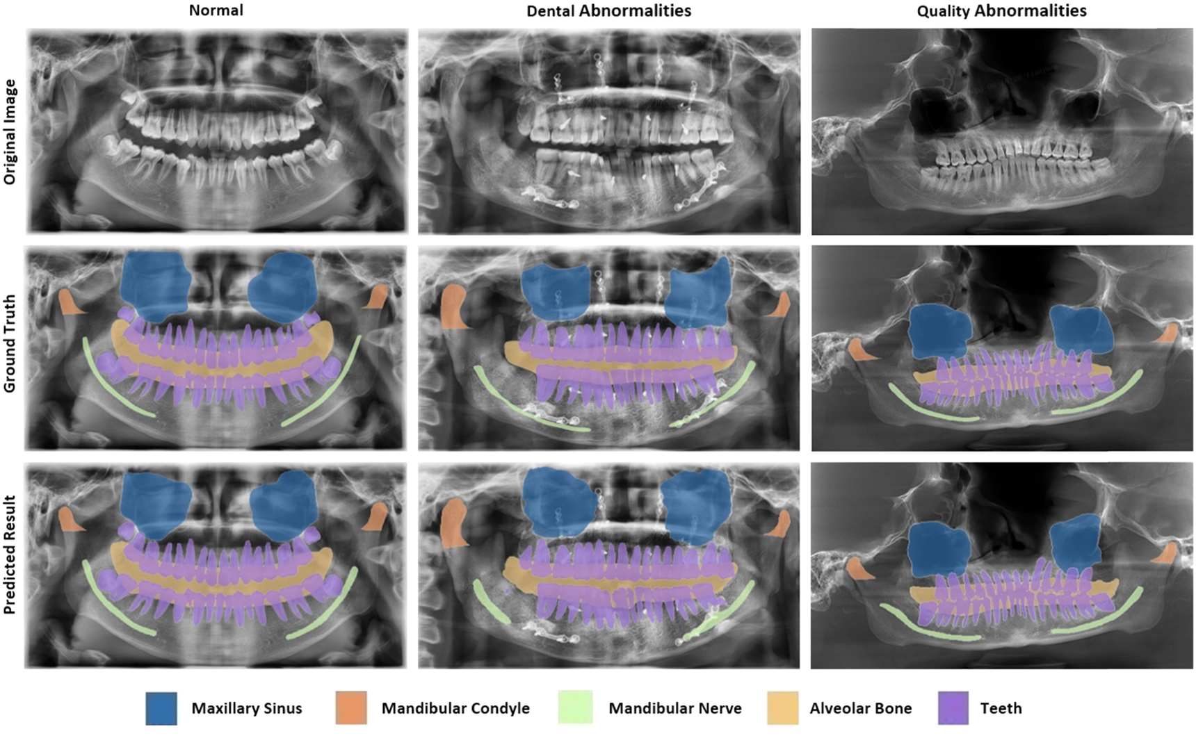 Coarse-to-fine prior-guided attention network for multi-structure ...