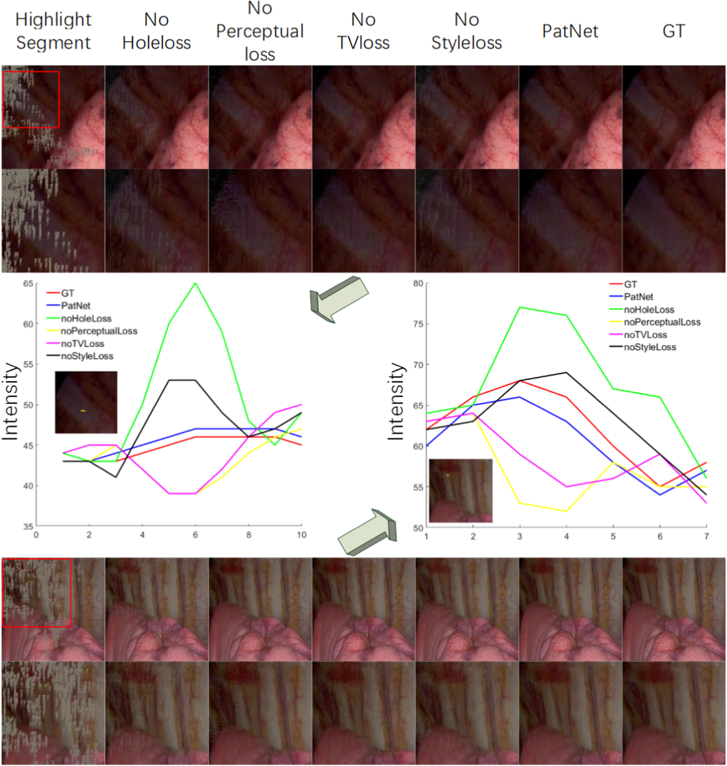 Specular highlight removal for endoscopic images using partial