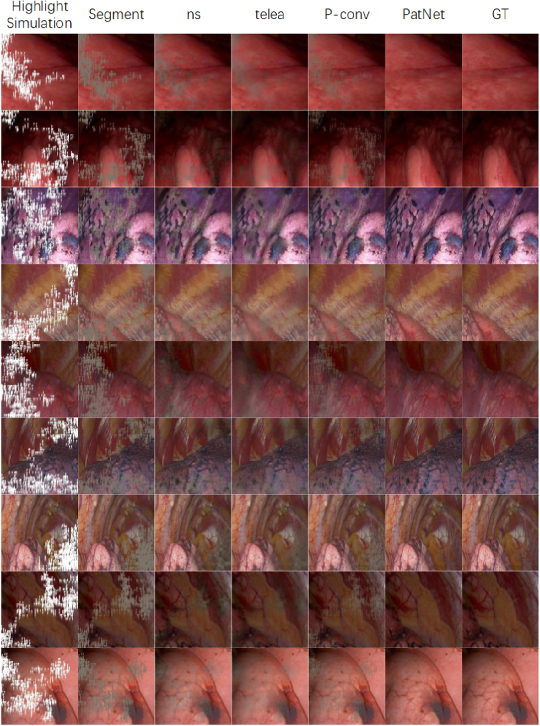 Specular highlight removal for endoscopic images using partial